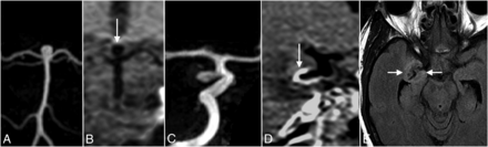 Fig 5.