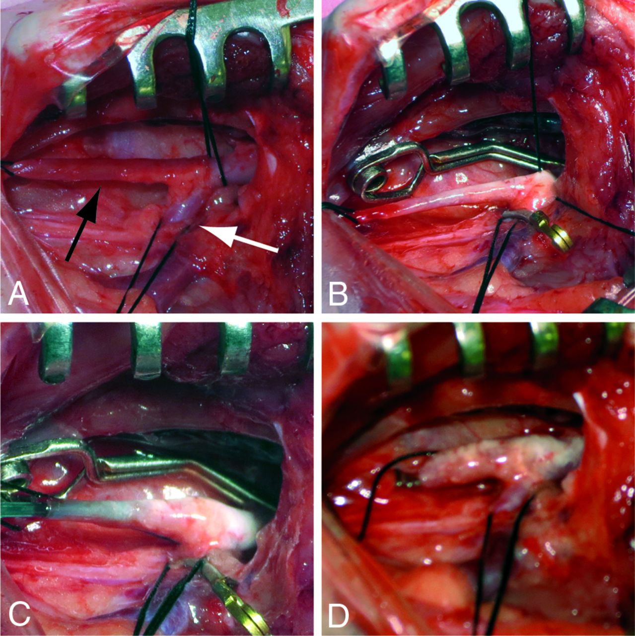 Testing Stenting and Flow Diversion Using a Surgical Elastase-Induced ...