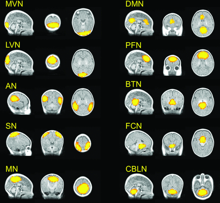 Fig 1.