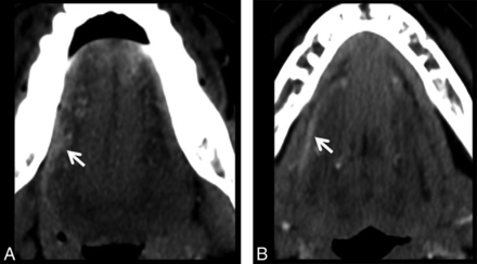 Fig 6.