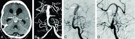 Fig 1.