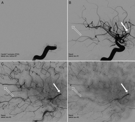 Fig 1.