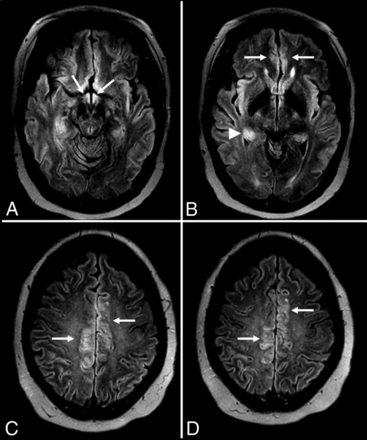 Fig 3.