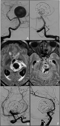 Fig 3.