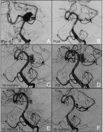 Fig 4.