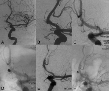 Fig 2.