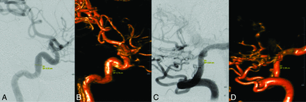 Fig 1.