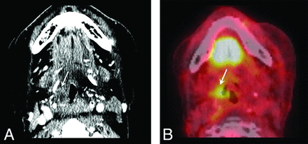 Fig 4.