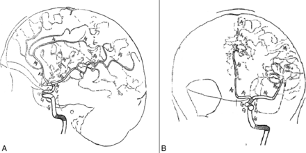 Fig 1.