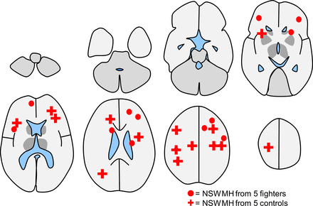 Fig 5.