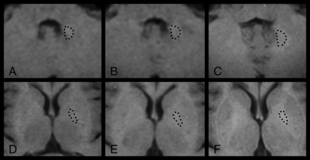 Fig 2.