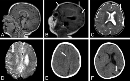 Fig 2.