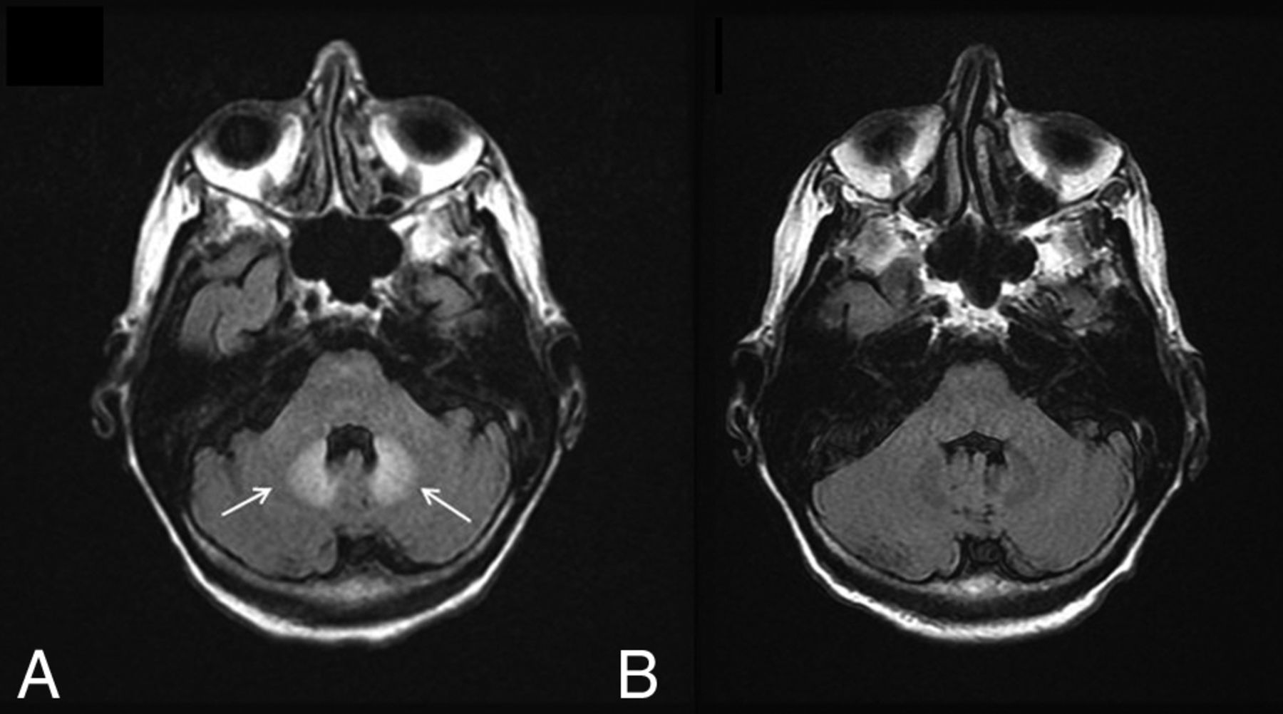 Dentate Update: Imaging Features of Entities That Affect the