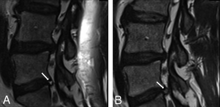 Fig 2.