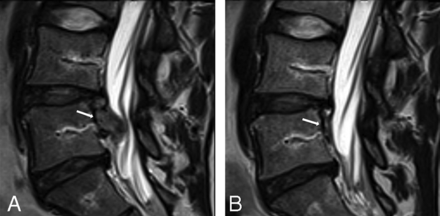 Fig 3.