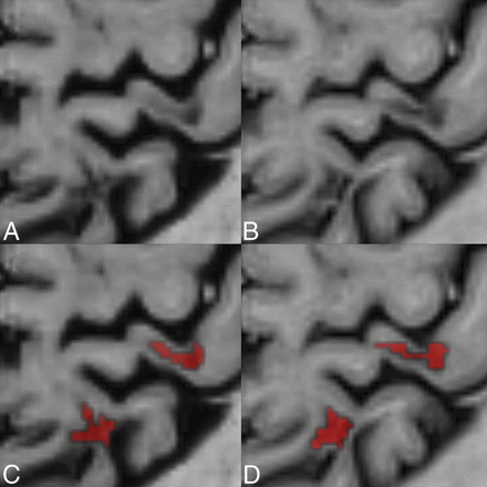 Fig 2.