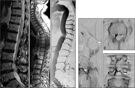 Fig 2.