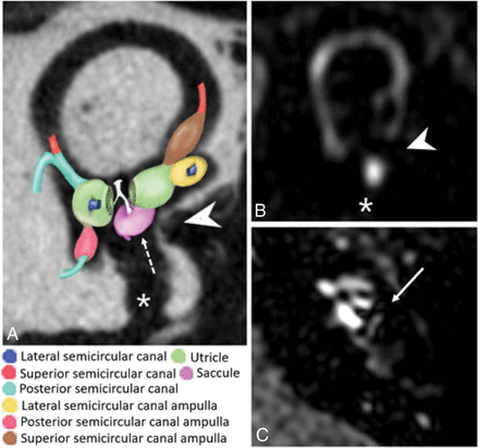 Fig 2.