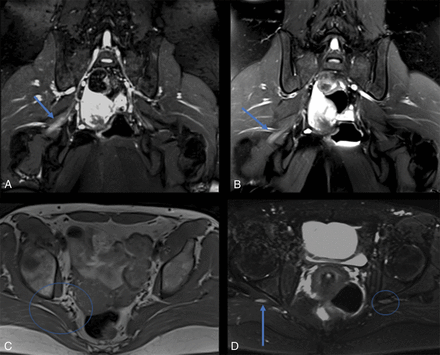 Fig 4.