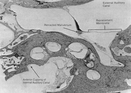 Fig 2.