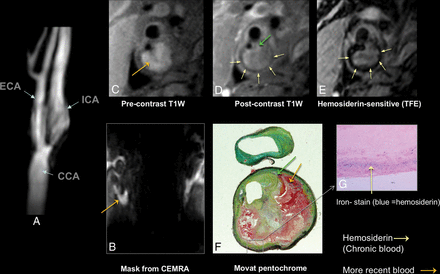 Fig 3.