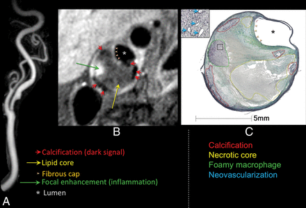 Fig 4.