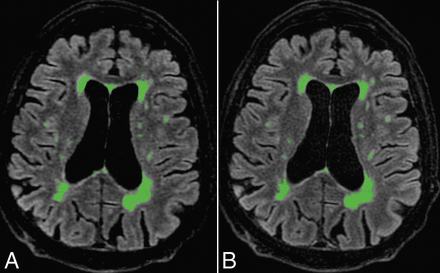 Fig 4.