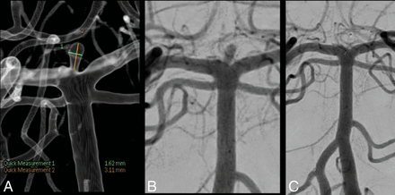 Fig 3.