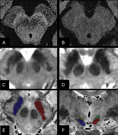 Fig 1.