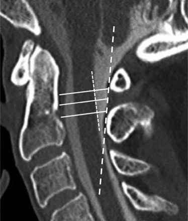 Fig 3.