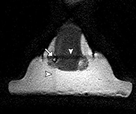 Fig 1.