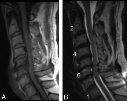 Fig 1.