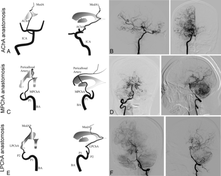 Fig 1.