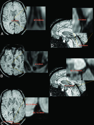 Fig 2.