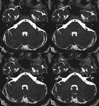 Fig 2.