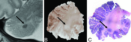 Fig 1.