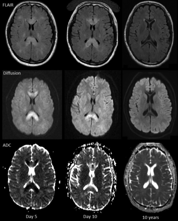 Fig 3.