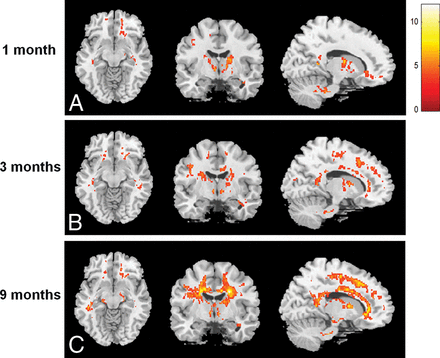 Fig 3.