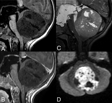 Fig 3.