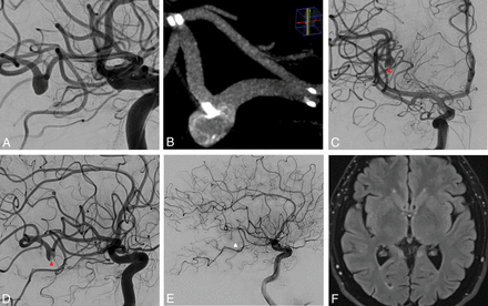 Fig 4.