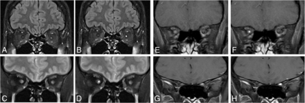 Fig 3.