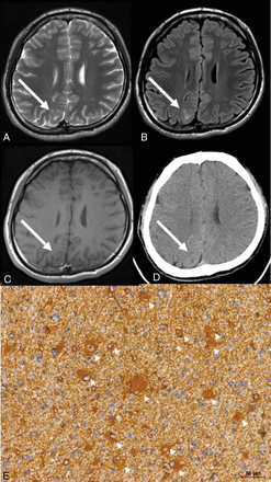 Fig 3.