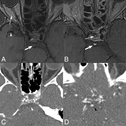 Fig 3.