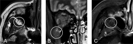 Fig 2.