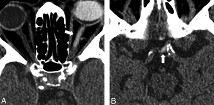 Fig 2.