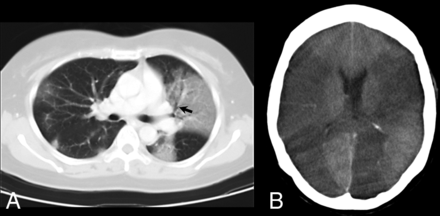 FIG 4.