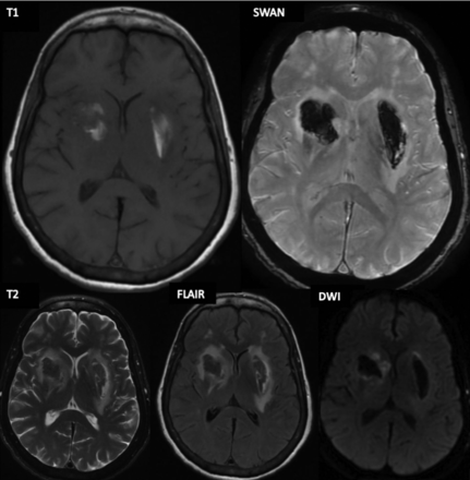 FIG 2.