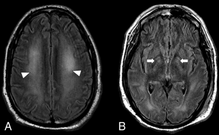 FIG 5.