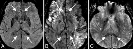 FIG 2.