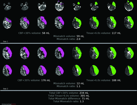 FIG 6.